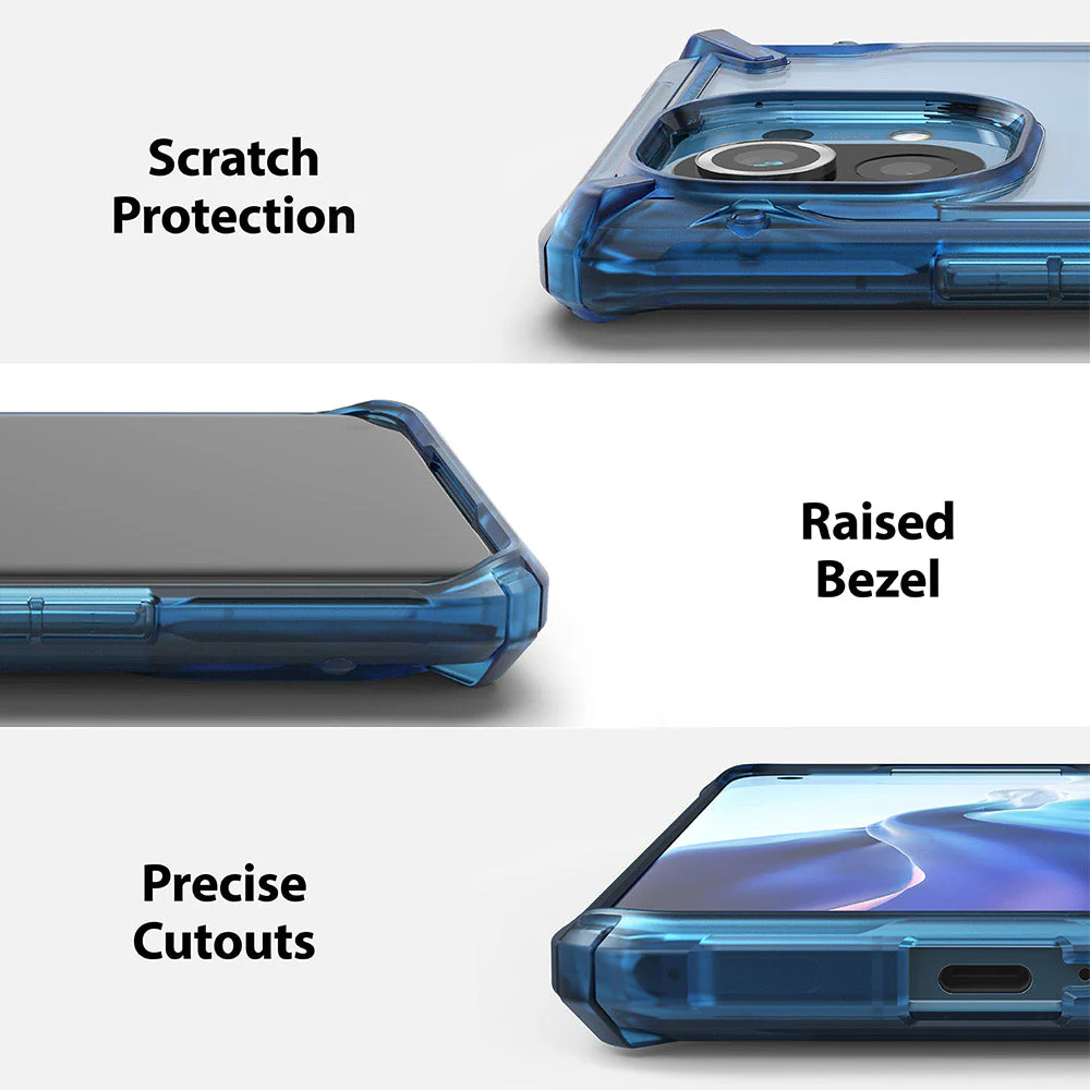 Mi 11 Case | Fusion-X - Image 18